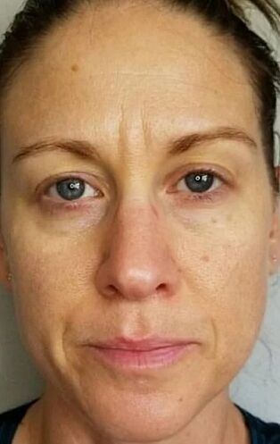 All'età di 40 anni, sono apparse profonde rughe e macchie di età